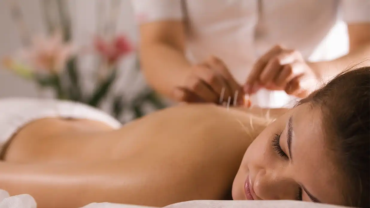 acupuncture