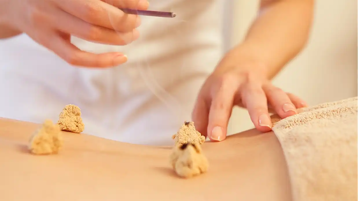 moxibustion